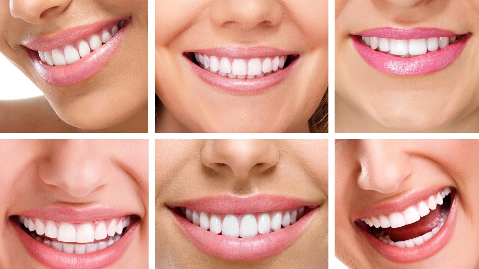Implantacja natychmiastowa umożliwia zachowanie efektownego uśmiechu