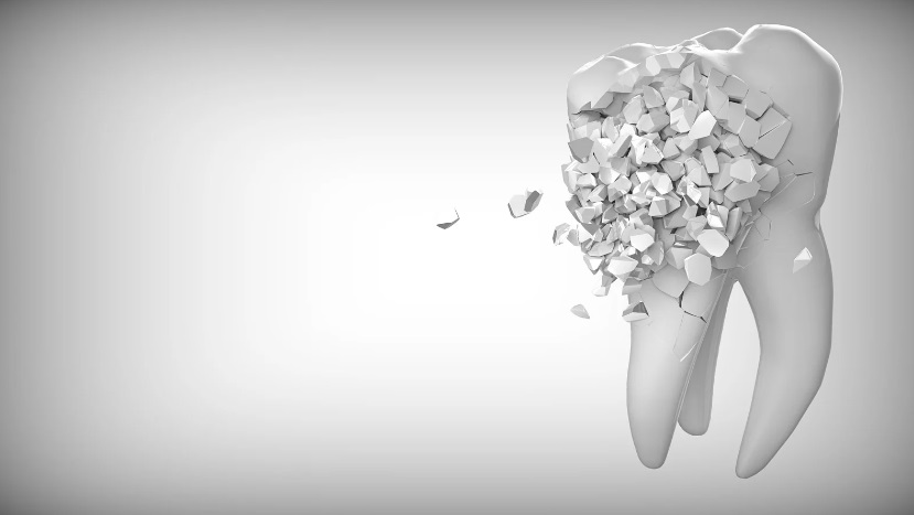 Nowoczesne leczenie wczesnej próchnicy laserem: Skuteczna metoda zapobiegania rozwojowi chorób jamy ustnej
